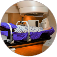 SBRT Stereotactic Body Radiation Therapy