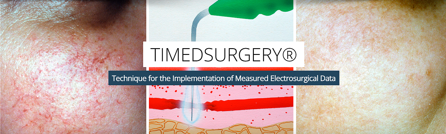 timedsurgery-Capurro-electrocirugia-surgest medical